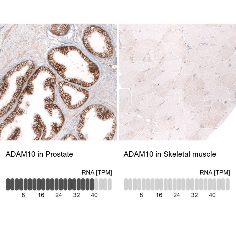 ADAM10 Antibody (CL13815) - Azide and BSA Free Immunohistochemistry-Paraffin: ADAM10 Antibody [NBP3-43827]