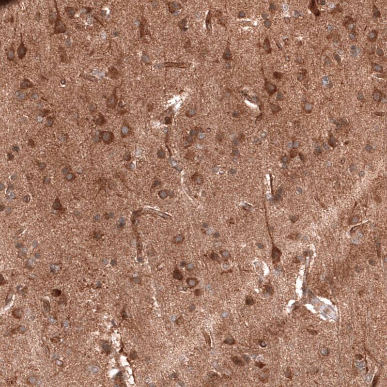 ADAM10 Antibody (CL13815) - Azide and BSA Free Immunohistochemistry-Paraffin: ADAM10 Antibody [NBP3-43827]