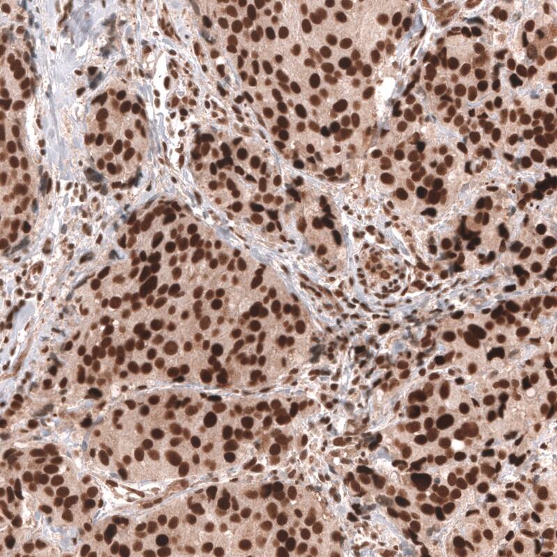 BCOR Antibody (CL13841) - Azide and BSA Free Immunohistochemistry-Paraffin: BCOR Antibody [NBP3-43828]
