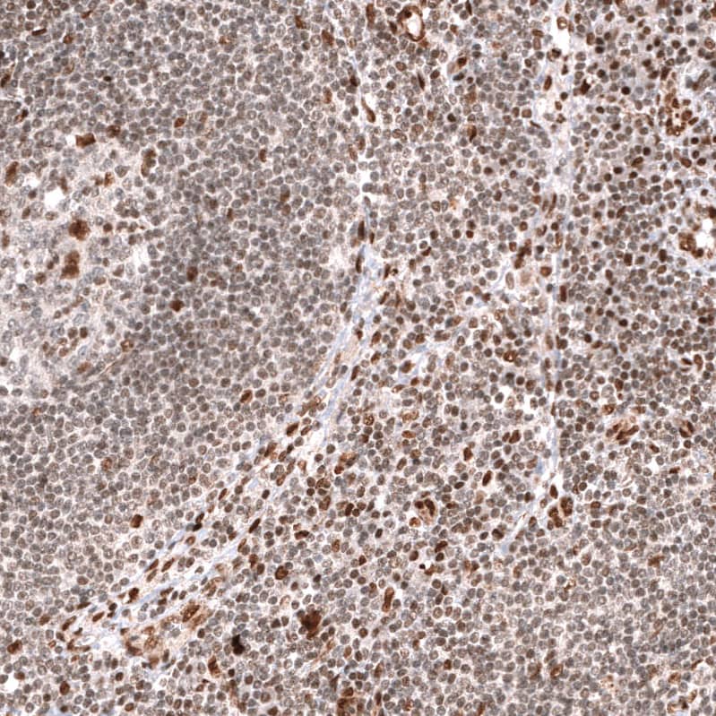 BCOR Antibody (CL13841) - Azide and BSA Free Immunohistochemistry-Paraffin: BCOR Antibody [NBP3-43828]