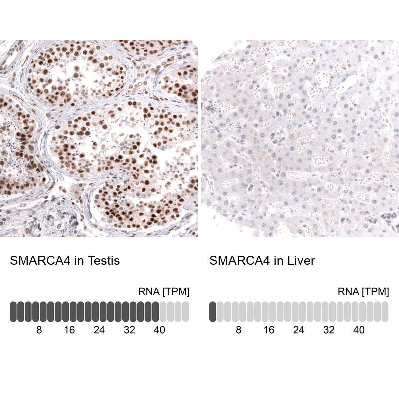 Brg1 Antibody (CL13783) - Azide and BSA Free Immunohistochemistry-Paraffin: Brg1 Antibody [NBP3-43830]