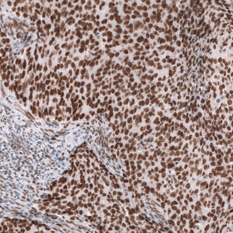 Brg1 Antibody (CL13783) - Azide and BSA Free Immunohistochemistry-Paraffin: Brg1 Antibody [NBP3-43830]