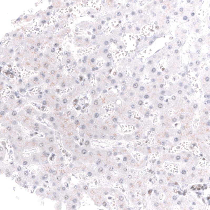 Brg1 Antibody (CL13783) - Azide and BSA Free Immunohistochemistry-Paraffin: Brg1 Antibody [NBP3-43830]