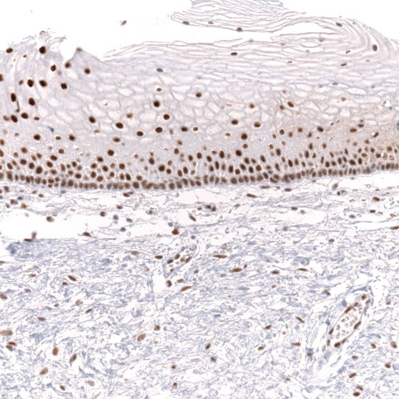 Brg1 Antibody (CL13783) - Azide and BSA Free Immunohistochemistry-Paraffin: Brg1 Antibody [NBP3-43830]