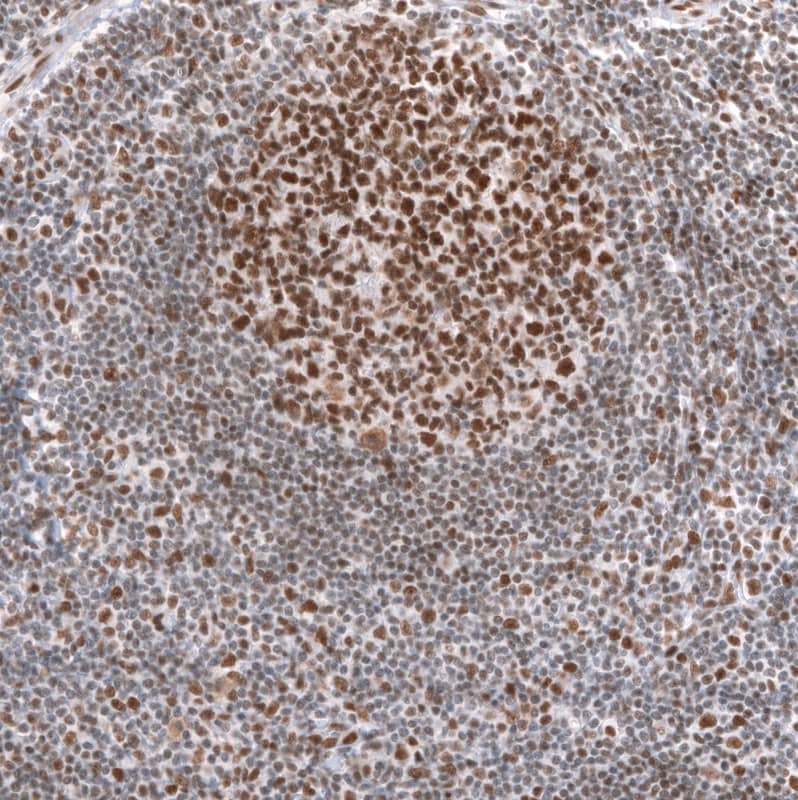 Brg1 Antibody (CL13783) - Azide and BSA Free Immunohistochemistry-Paraffin: Brg1 Antibody [NBP3-43830]