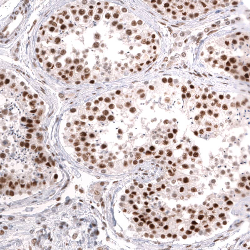 Brg1 Antibody (CL13783) - Azide and BSA Free Immunohistochemistry-Paraffin: Brg1 Antibody [NBP3-43830]