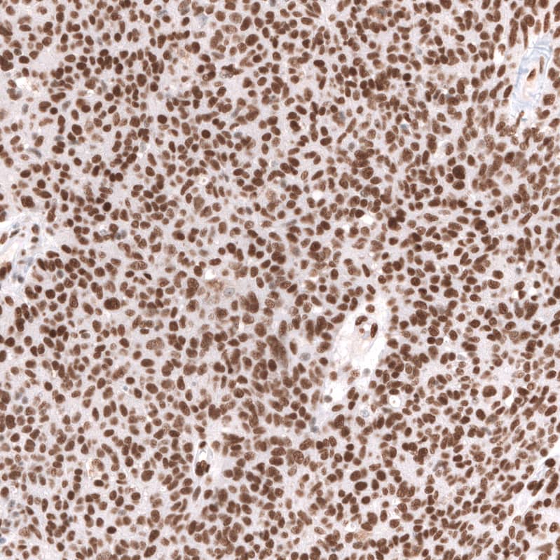 Brg1 Antibody (CL13783) - Azide and BSA Free Immunohistochemistry-Paraffin: Brg1 Antibody [NBP3-43830]