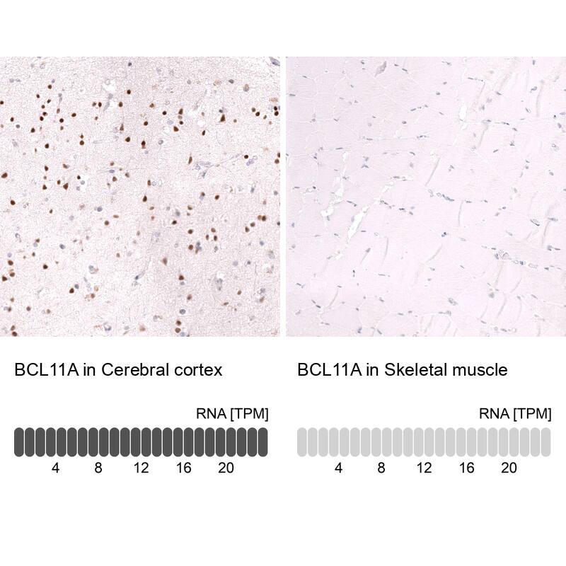 Ctip1 Antibody (CL13501) - Azide and BSA Free Immunohistochemistry-Paraffin: Ctip1 Antibody [NBP3-43831]