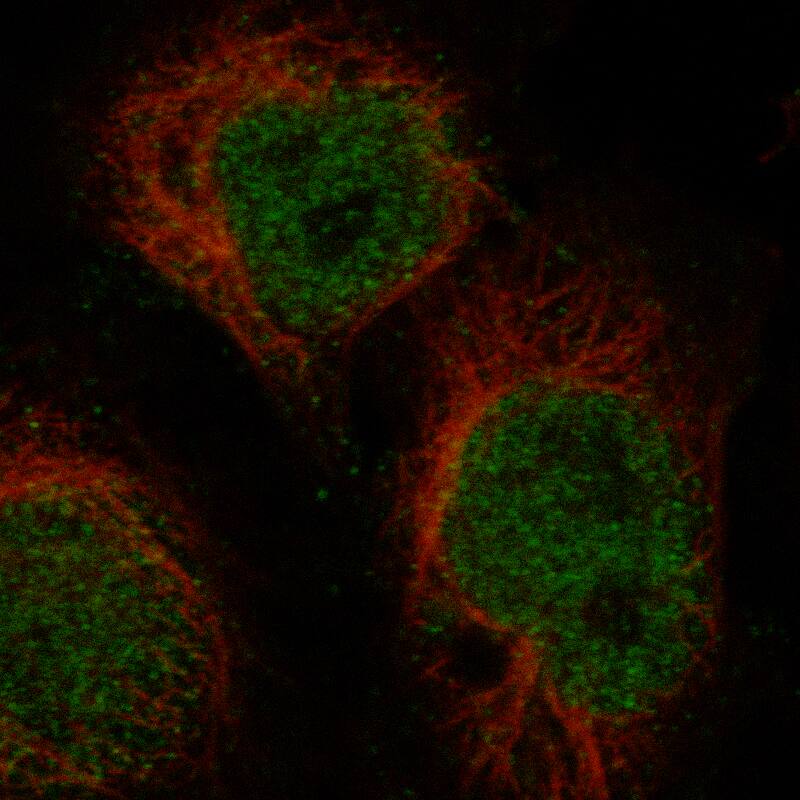 Ctip1 Antibody (CL13501) - Azide and BSA Free Immunocytochemistry/ Immunofluorescence: Ctip1 Antibody [NBP3-43831]