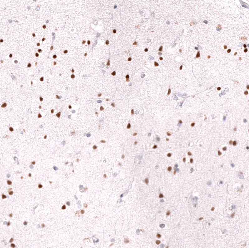 Ctip1 Antibody (CL13501) - Azide and BSA Free Immunohistochemistry-Paraffin: Ctip1 Antibody [NBP3-43831]