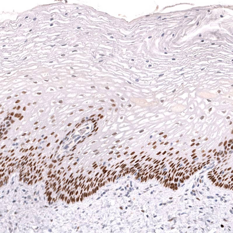 Ctip1 Antibody (CL13501) - Azide and BSA Free Immunohistochemistry-Paraffin: Ctip1 Antibody [NBP3-43831]