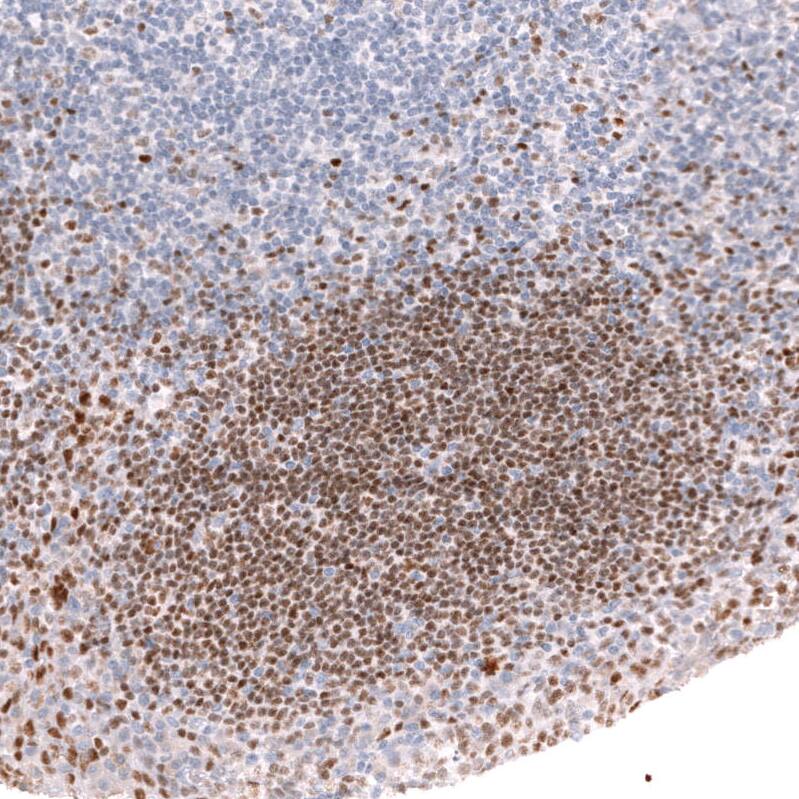 Ctip1 Antibody (CL13501) - Azide and BSA Free Immunohistochemistry-Paraffin: Ctip1 Antibody [NBP3-43831]