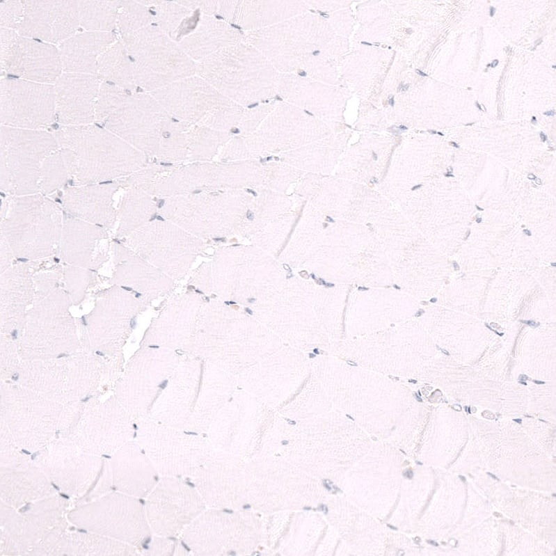 Ctip1 Antibody (CL13501) - Azide and BSA Free Immunohistochemistry-Paraffin: Ctip1 Antibody [NBP3-43831]