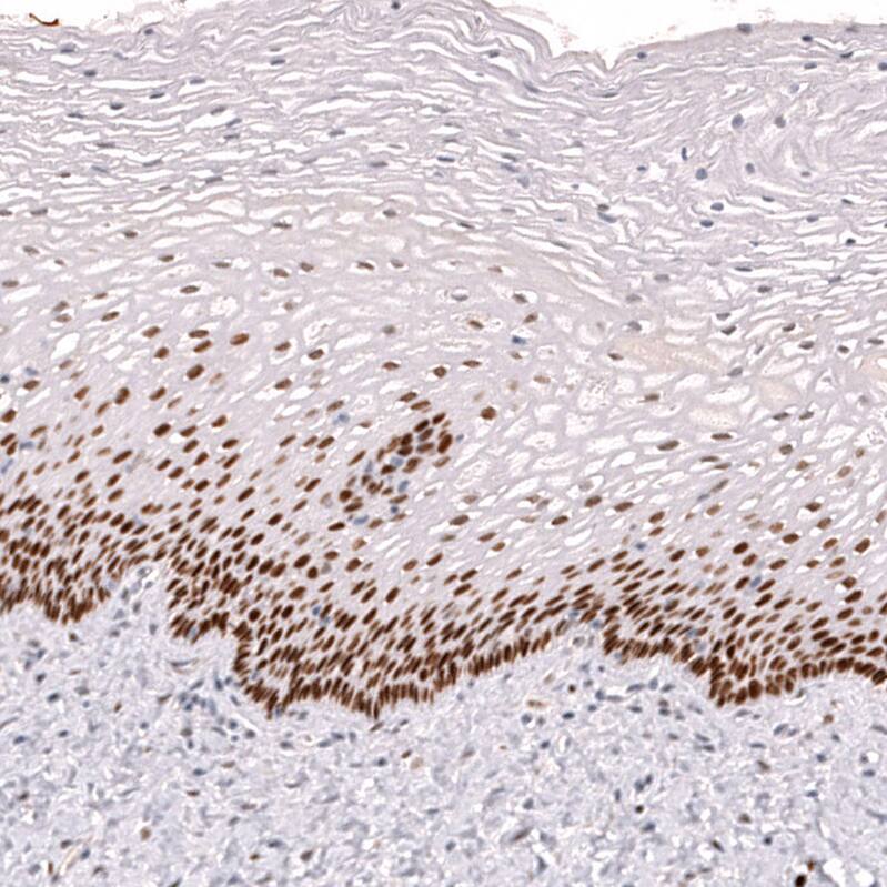 Ctip1 Antibody (CL13530) - Azide and BSA Free Immunohistochemistry-Paraffin: Ctip1 Antibody [NBP3-43832]