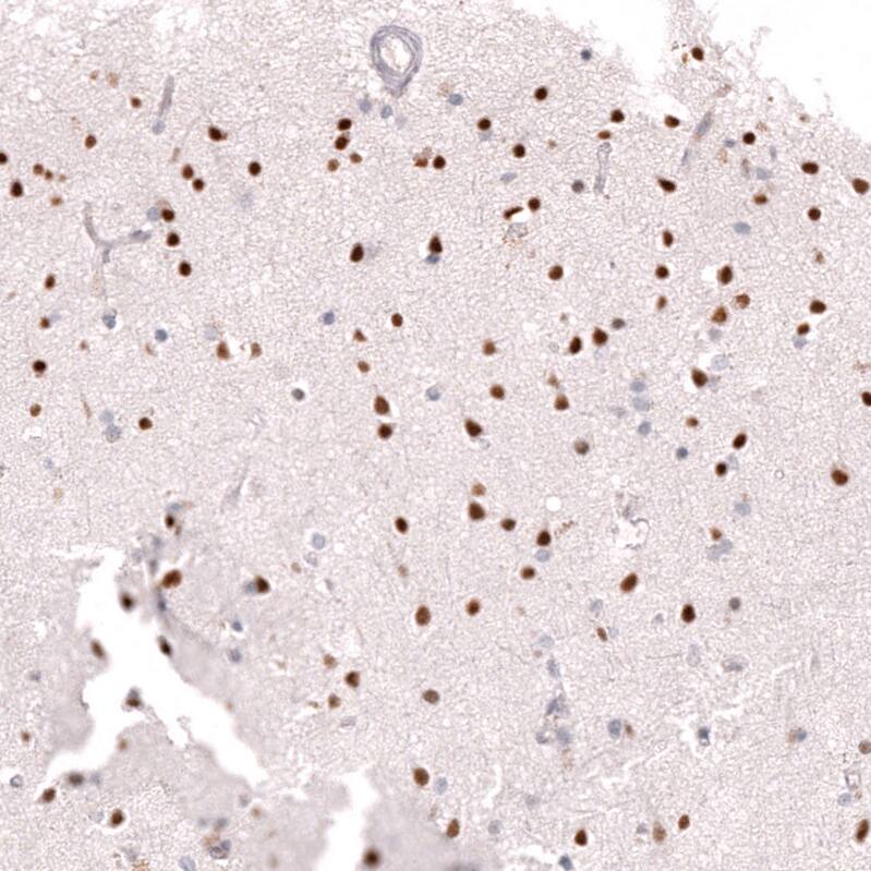 Ctip1 Antibody (CL13530) - Azide and BSA Free Immunohistochemistry-Paraffin: Ctip1 Antibody [NBP3-43832]