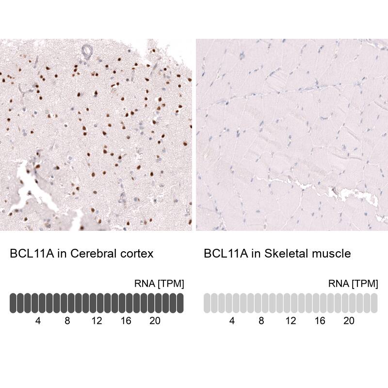 Ctip1 Antibody (CL13530) - Azide and BSA Free Immunohistochemistry-Paraffin: Ctip1 Antibody [NBP3-43832]