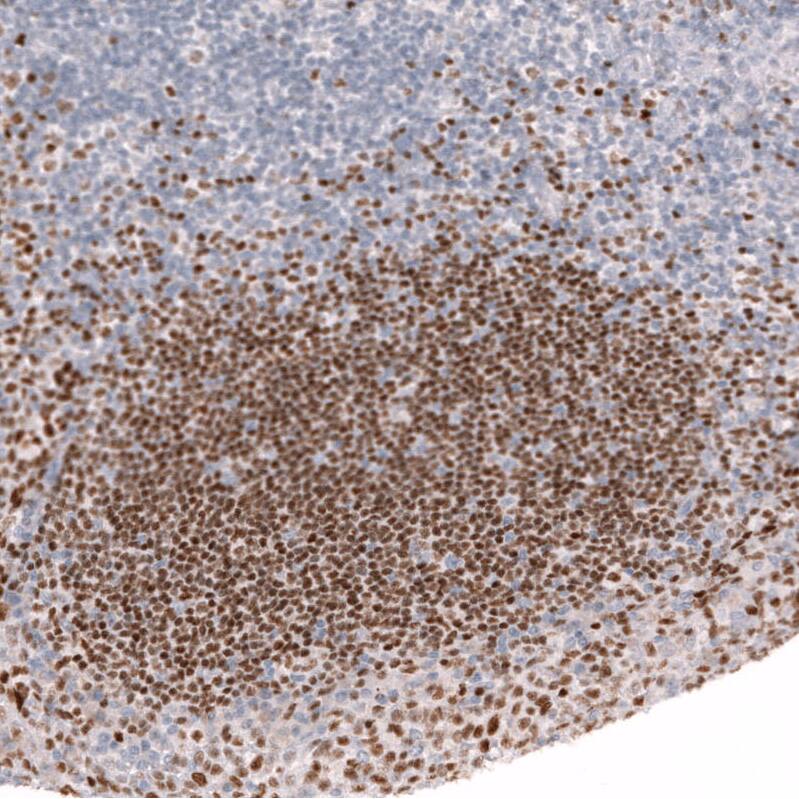 Ctip1 Antibody (CL13530) - Azide and BSA Free Immunohistochemistry-Paraffin: Ctip1 Antibody [NBP3-43832]