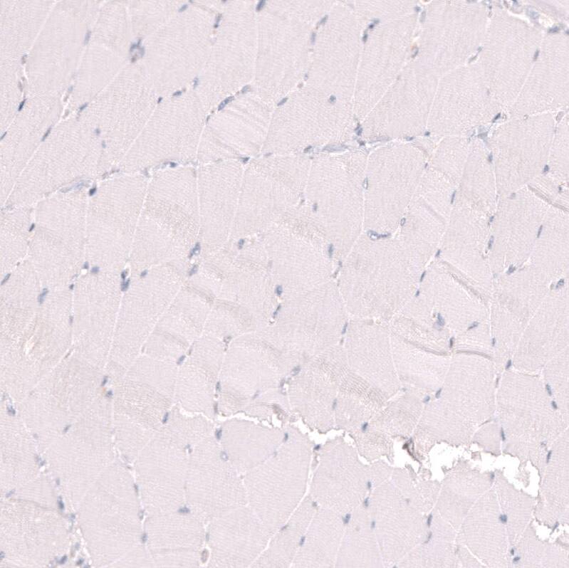 Ctip1 Antibody (CL13530) - Azide and BSA Free Immunohistochemistry-Paraffin: Ctip1 Antibody [NBP3-43832]