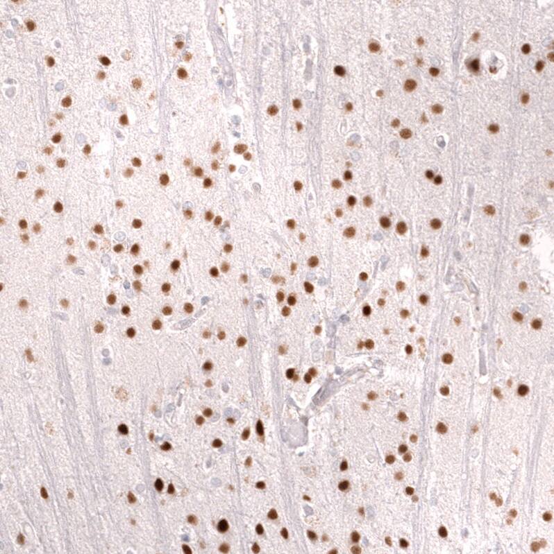 FOXO3 Antibody (CL13589) - Azide and BSA Free Immunohistochemistry-Paraffin: FOXO3 Antibody [NBP3-43833]