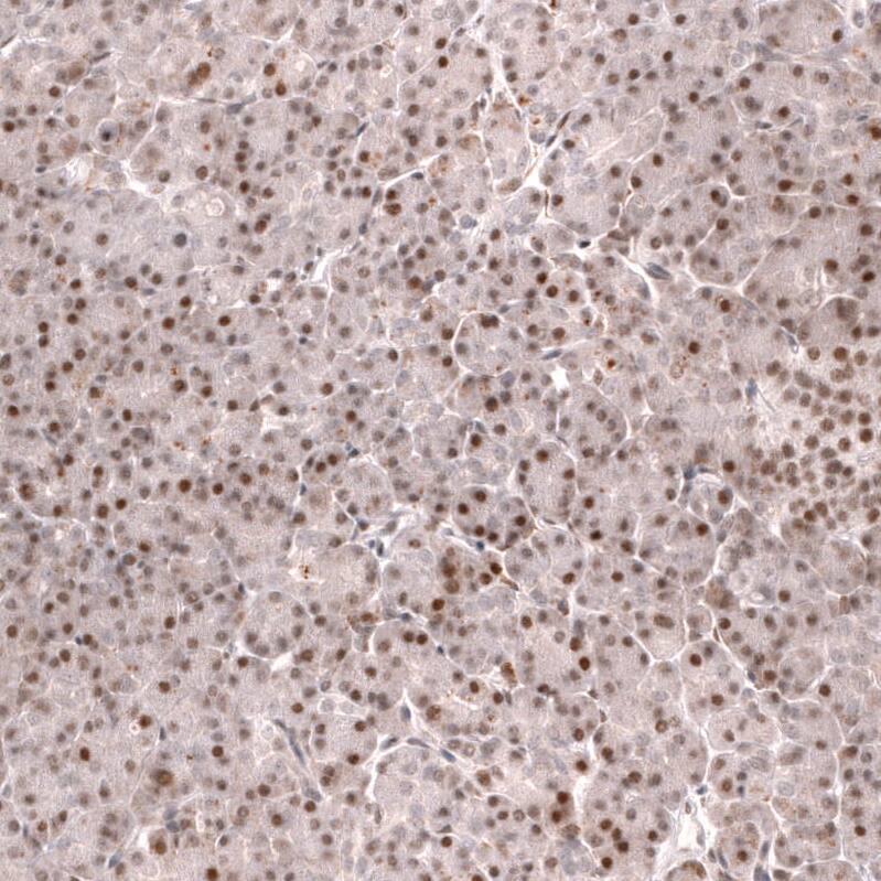 FOXO3 Antibody (CL13589) - Azide and BSA Free Immunohistochemistry-Paraffin: FOXO3 Antibody [NBP3-43833]
