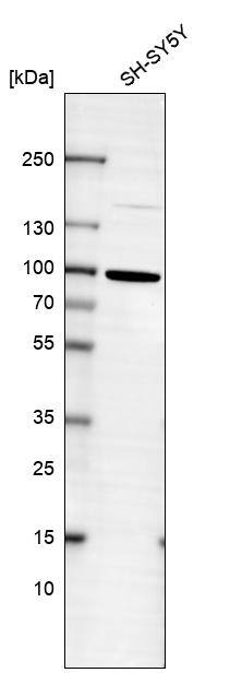 FOXO3 Antibody (CL13589) - Azide and BSA Free Western Blot: FOXO3 Antibody [NBP3-43833]