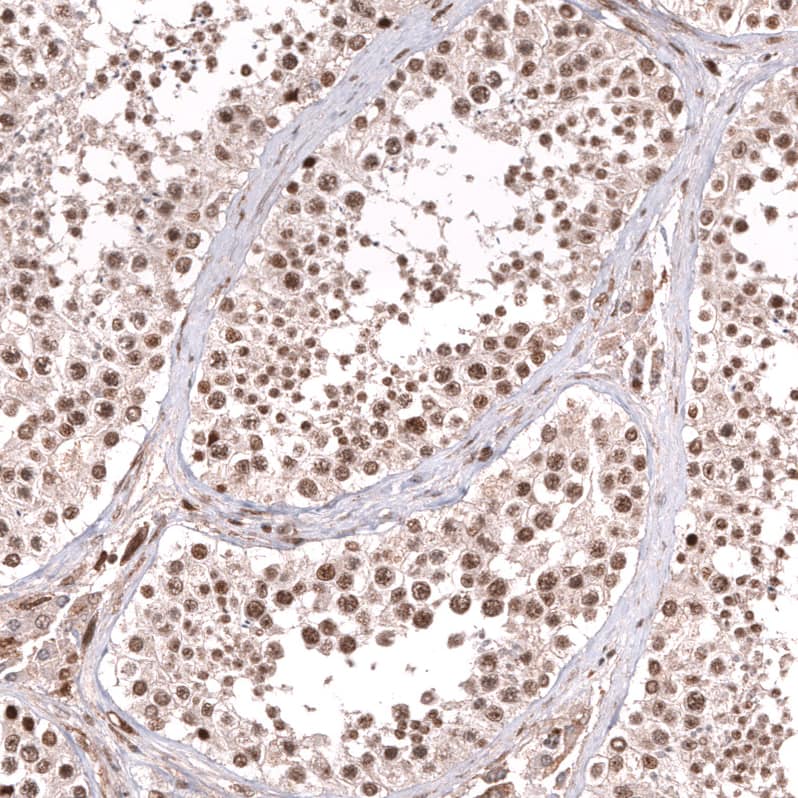 FOXO3 Antibody (CL13603) - Azide and BSA Free Immunohistochemistry-Paraffin: FOXO3 Antibody [NBP3-43834]