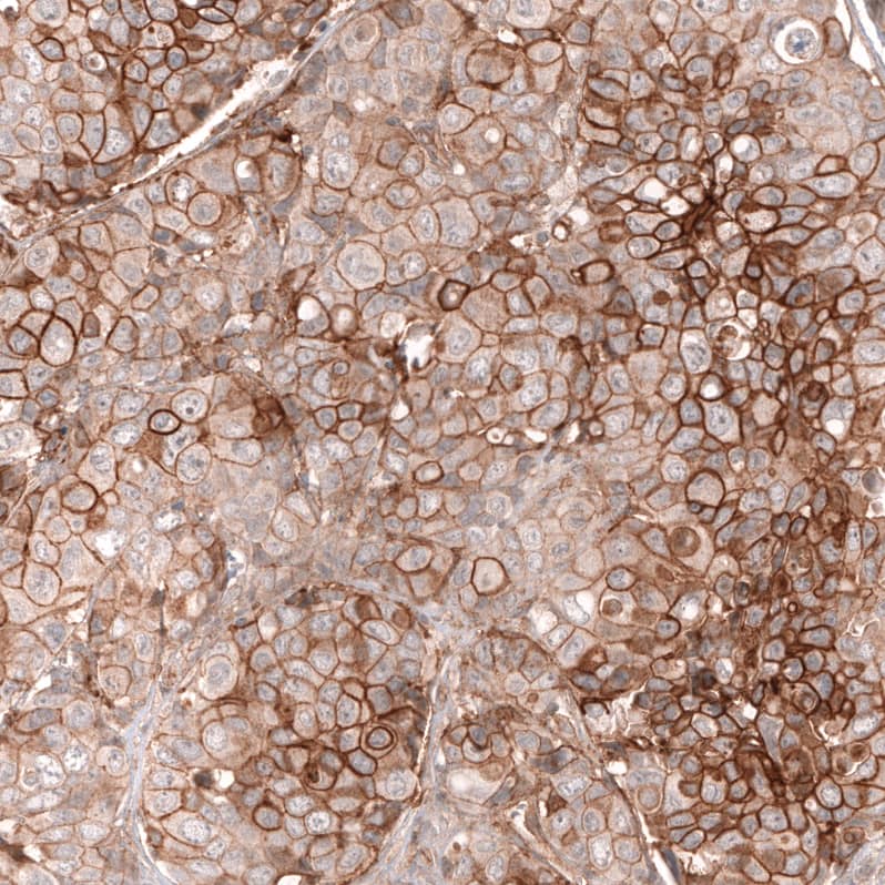 FXYD5/Dysadherin Antibody (CL14037) - Azide and BSA Free Immunohistochemistry-Paraffin: FXYD5/Dysadherin Antibody [NBP3-43835]