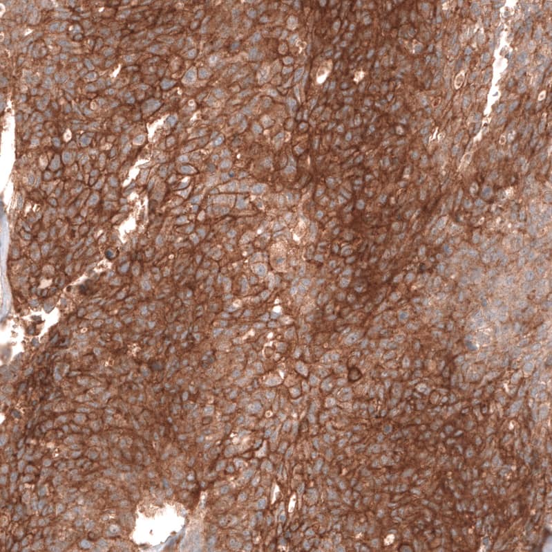 FXYD5/Dysadherin Antibody (CL14037) - Azide and BSA Free Immunohistochemistry-Paraffin: FXYD5/Dysadherin Antibody [NBP3-43835]