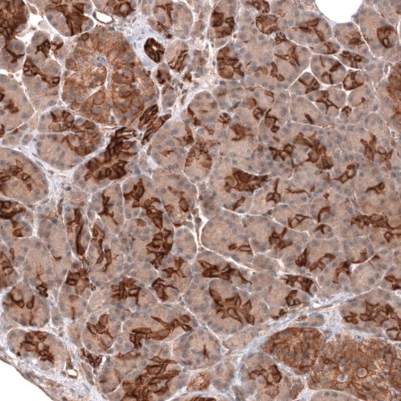 FXYD5/Dysadherin Antibody (CL14037) - Azide and BSA Free Immunohistochemistry-Paraffin: FXYD5/Dysadherin Antibody [NBP3-43835]