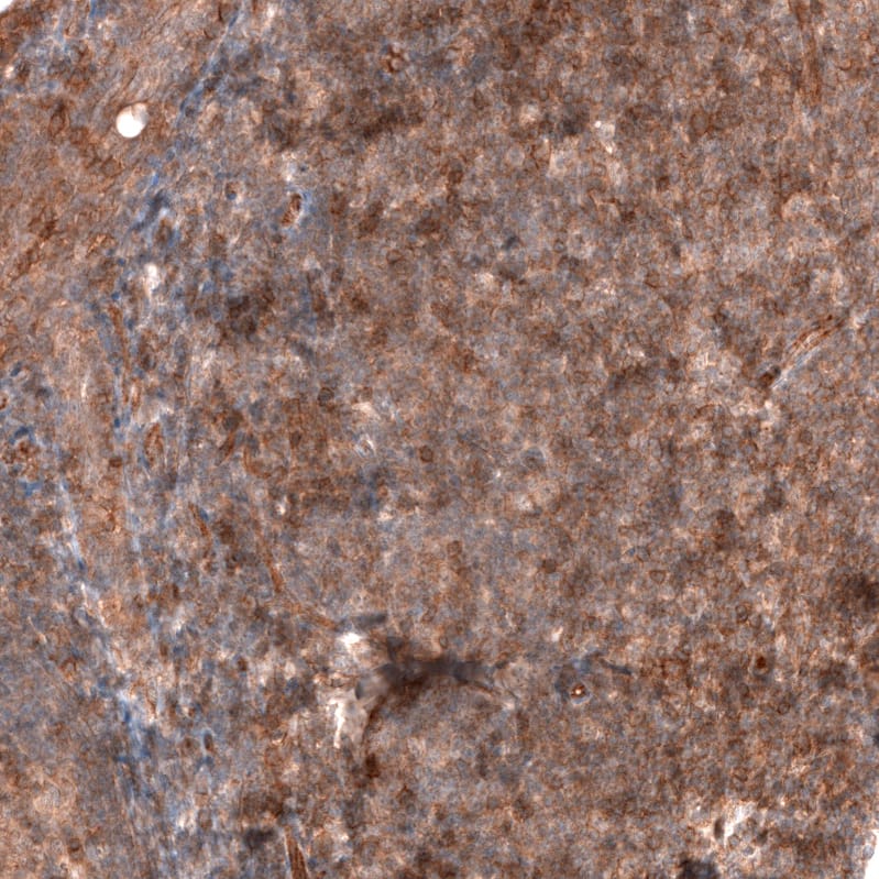 FXYD5/Dysadherin Antibody (CL14037) - Azide and BSA Free Immunohistochemistry-Paraffin: FXYD5/Dysadherin Antibody [NBP3-43835]