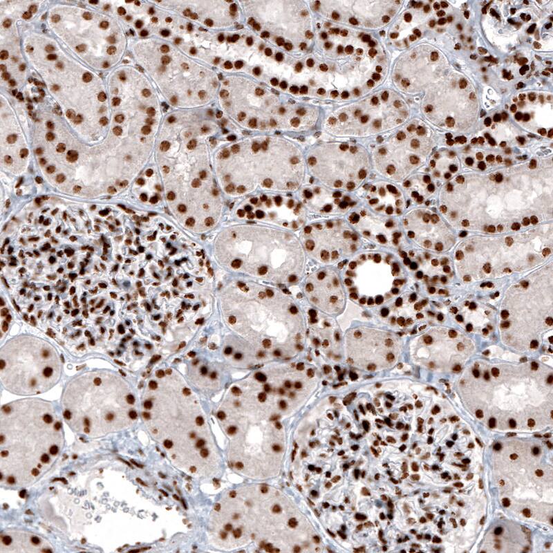 Histone H2AY/macroH2A.1 Antibody (CL5256) - Azide and BSA Free Immunohistochemistry-Paraffin: Histone H2AY/macroH2A.1 Antibody [NBP3-43837]