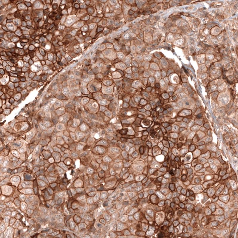 FXYD5/Dysadherin Antibody (CL14039) - Azide and BSA Free Immunohistochemistry-Paraffin: FXYD5/Dysadherin Antibody [NBP3-43838]