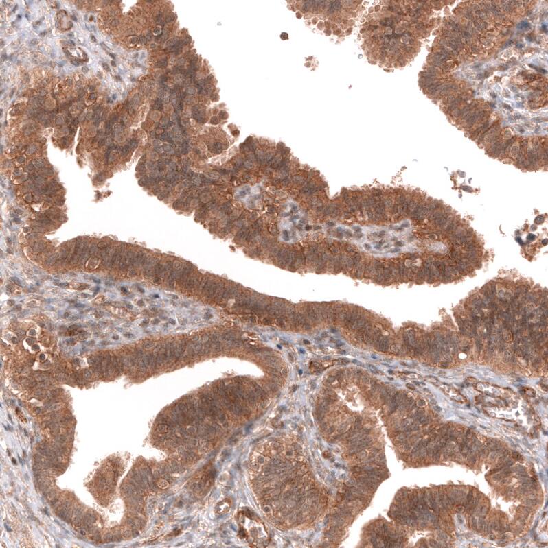 FXYD5/Dysadherin Antibody (CL14039) - Azide and BSA Free Immunohistochemistry-Paraffin: FXYD5/Dysadherin Antibody [NBP3-43838]