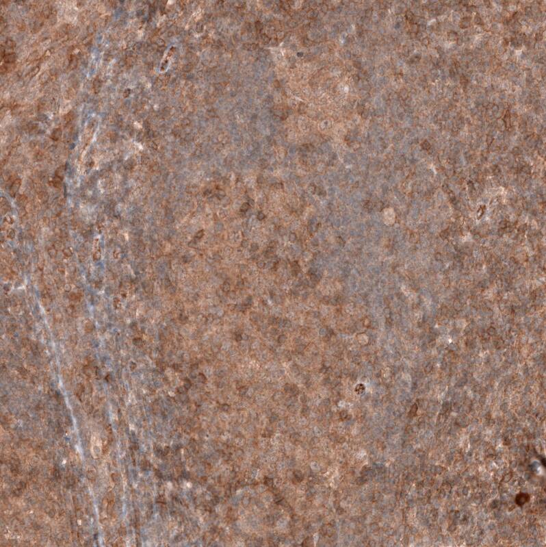 FXYD5/Dysadherin Antibody (CL14039) - Azide and BSA Free Immunohistochemistry-Paraffin: FXYD5/Dysadherin Antibody [NBP3-43838]