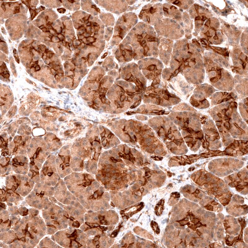 FXYD5/Dysadherin Antibody (CL14039) - Azide and BSA Free Immunohistochemistry-Paraffin: FXYD5/Dysadherin Antibody [NBP3-43838]