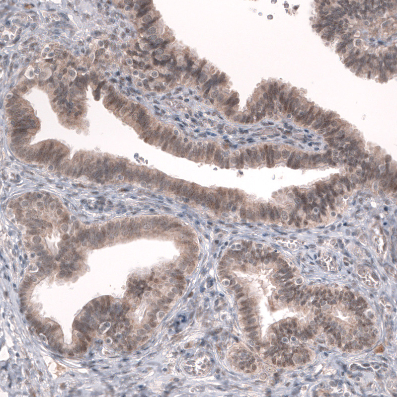 GREB1 Antibody (CL13859) - Azide and BSA Free Immunohistochemistry-Paraffin: GREB1 Antibody [NBP3-43839]