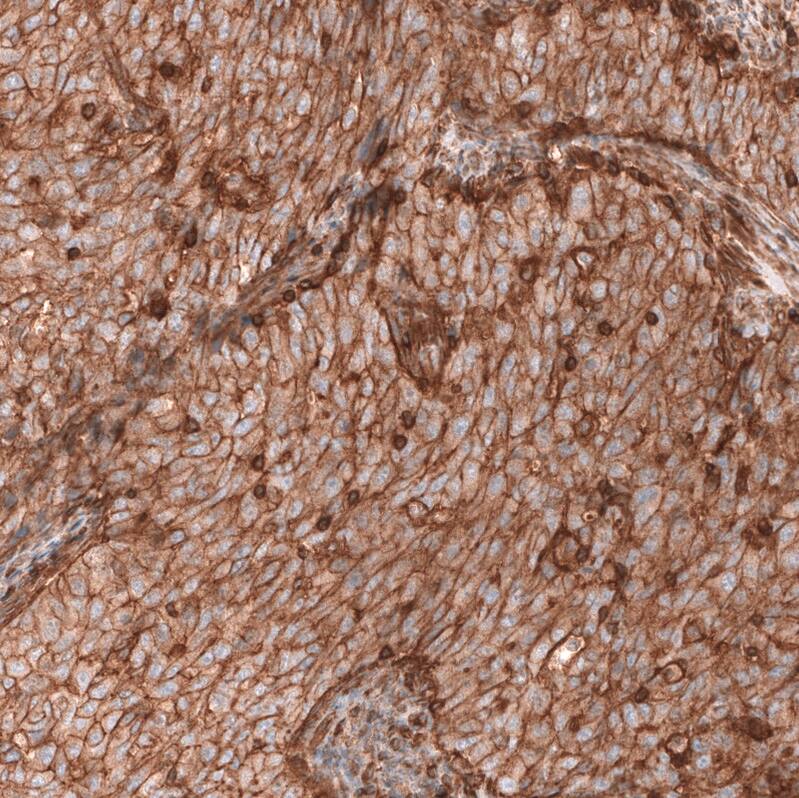 IGFBP-2 Antibody (CL13563) - Azide and BSA Free Immunohistochemistry-Paraffin: IGFBP-2 Antibody [NBP3-43841]