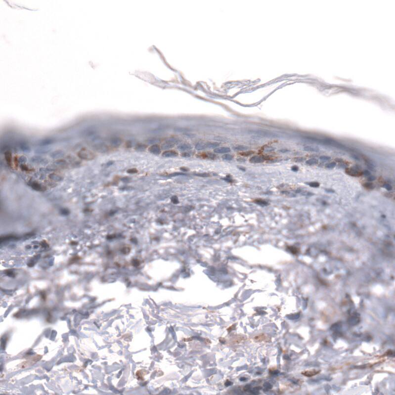 IGFBP-2 Antibody (CL13563) - Azide and BSA Free Immunohistochemistry-Paraffin: IGFBP-2 Antibody [NBP3-43841]