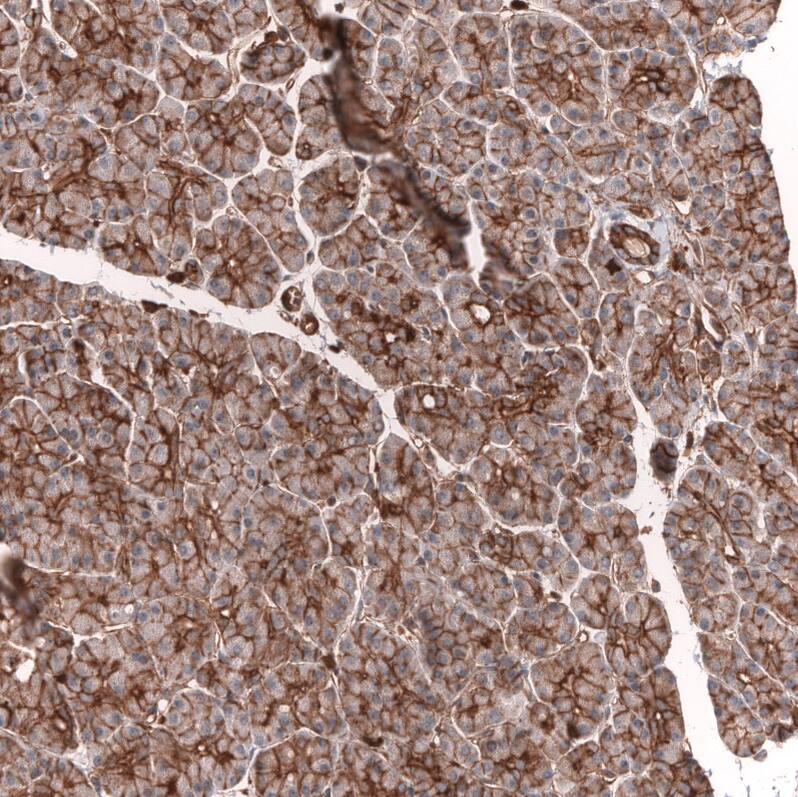 IGFBP-2 Antibody (CL13563) - Azide and BSA Free Immunohistochemistry-Paraffin: IGFBP-2 Antibody [NBP3-43841]