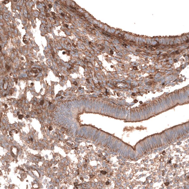 IGFBP-2 Antibody (CL13565) - Azide and BSA Free Immunohistochemistry-Paraffin: IGFBP-2 Antibody [NBP3-43842]