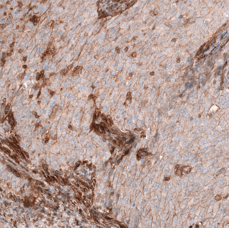 IGFBP-2 Antibody (CL13565) - Azide and BSA Free Immunohistochemistry-Paraffin: IGFBP-2 Antibody [NBP3-43842]