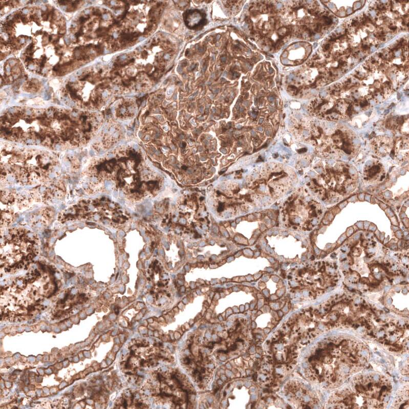 IGFBP-2 Antibody (CL13565) - Azide and BSA Free Immunohistochemistry-Paraffin: IGFBP-2 Antibody [NBP3-43842]