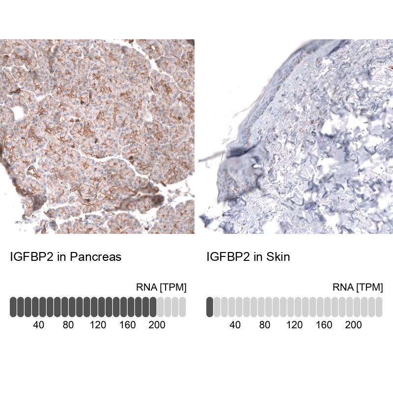 IGFBP-2 Antibody (CL13565) - Azide and BSA Free Immunohistochemistry-Paraffin: IGFBP-2 Antibody [NBP3-43842]