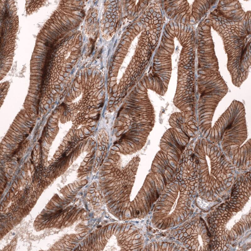 IGFBP-2 Antibody (CL13565) - Azide and BSA Free Immunohistochemistry-Paraffin: IGFBP-2 Antibody [NBP3-43842]