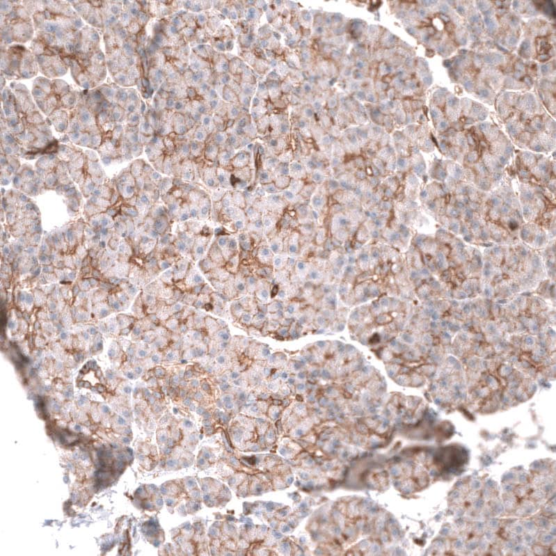 IGFBP-2 Antibody (CL13565) - Azide and BSA Free Immunohistochemistry-Paraffin: IGFBP-2 Antibody [NBP3-43842]
