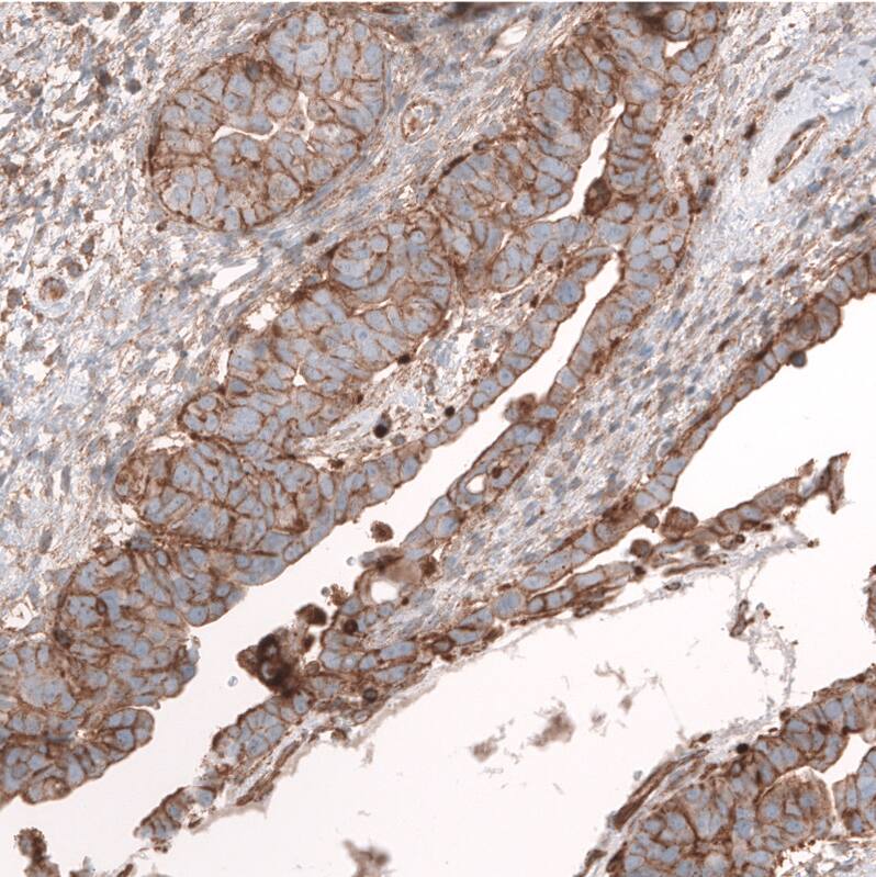 IGFBP-2 Antibody (CL13565) - Azide and BSA Free Immunohistochemistry-Paraffin: IGFBP-2 Antibody [NBP3-43842]