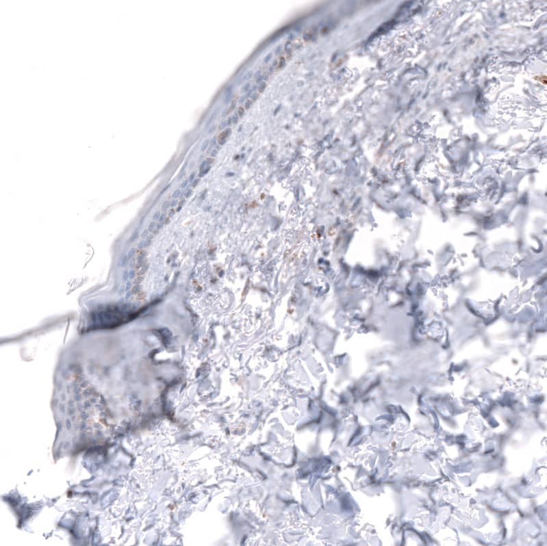 IGFBP-2 Antibody (CL13565) - Azide and BSA Free Immunohistochemistry-Paraffin: IGFBP-2 Antibody [NBP3-43842]