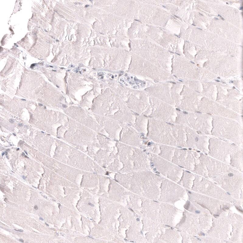 IL-33 Antibody (CL13438) - Azide and BSA Free Immunohistochemistry-Paraffin: IL-33 Antibody [NBP3-43843]