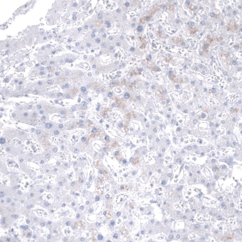 Mesothelin Antibody (CL13956) - Azide and BSA Free Immunohistochemistry-Paraffin: Mesothelin Antibody [NBP3-43845]