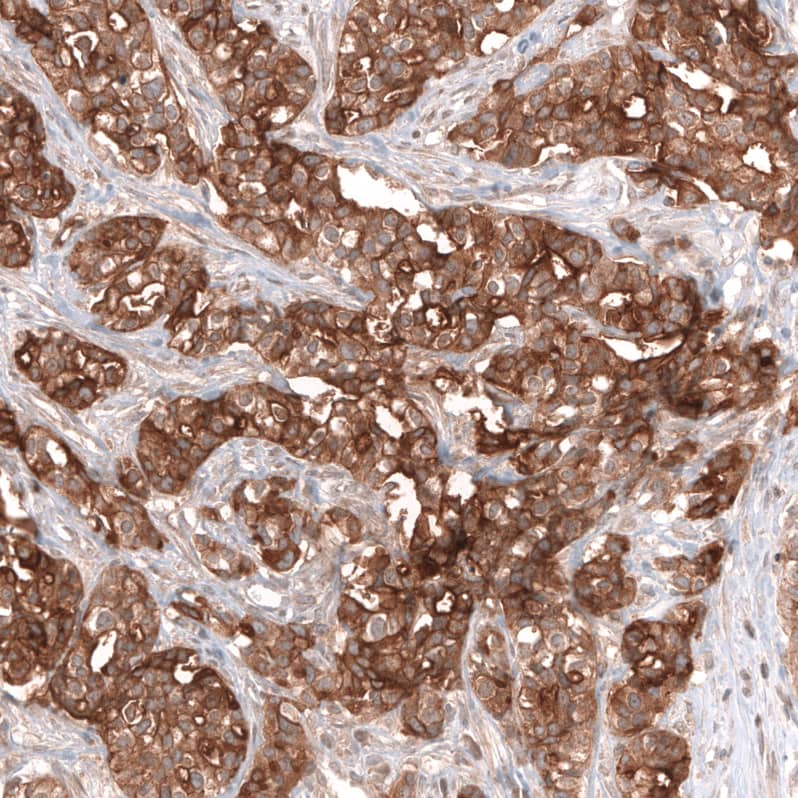Mesothelin Antibody (CL13956) - Azide and BSA Free Immunohistochemistry-Paraffin: Mesothelin Antibody [NBP3-43845]